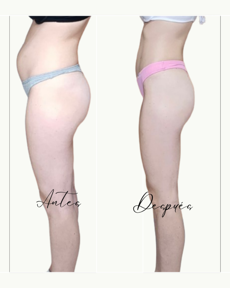 cambio antes y después de una chica que ha perdido 7 kilos