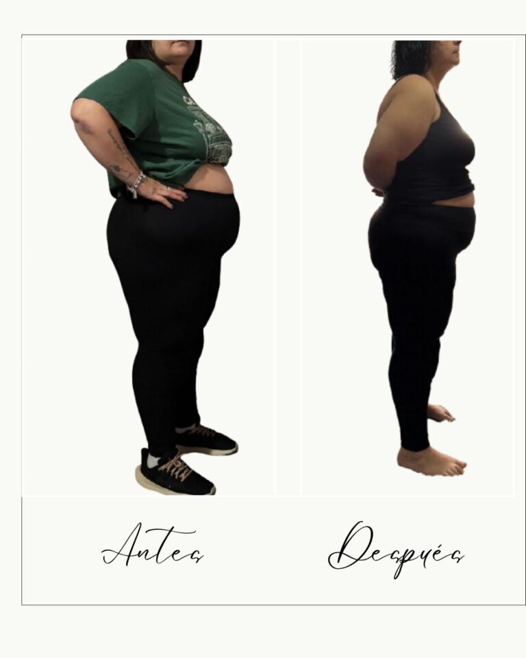 una imagen del antes y después de una chica que ha perdido 19 kilos, se nota menos volumen en la tripa